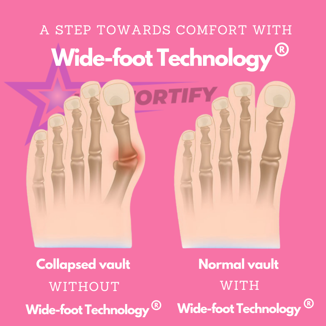 Ortho-MAX™ | Orthopedic shoes for women