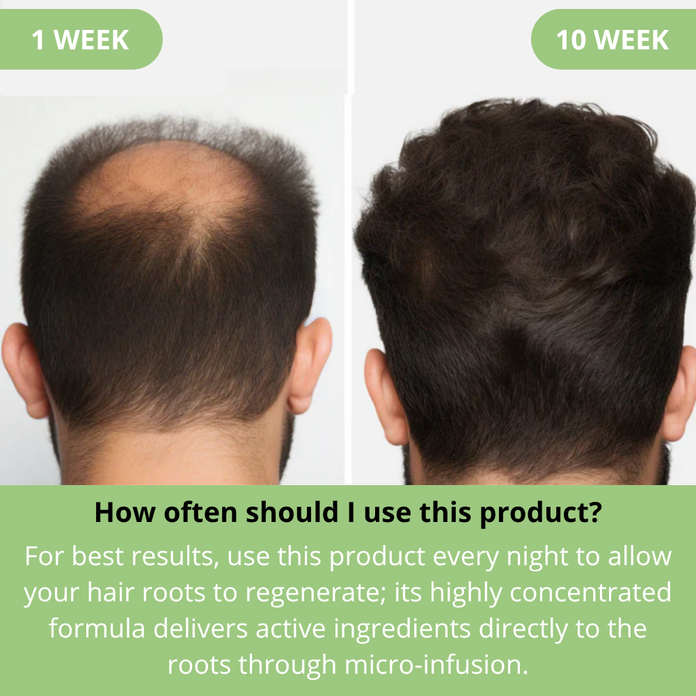 Hoegoa™ | Mikroinfusion zur Förderung des Haarwachstums für Männer und Frauen