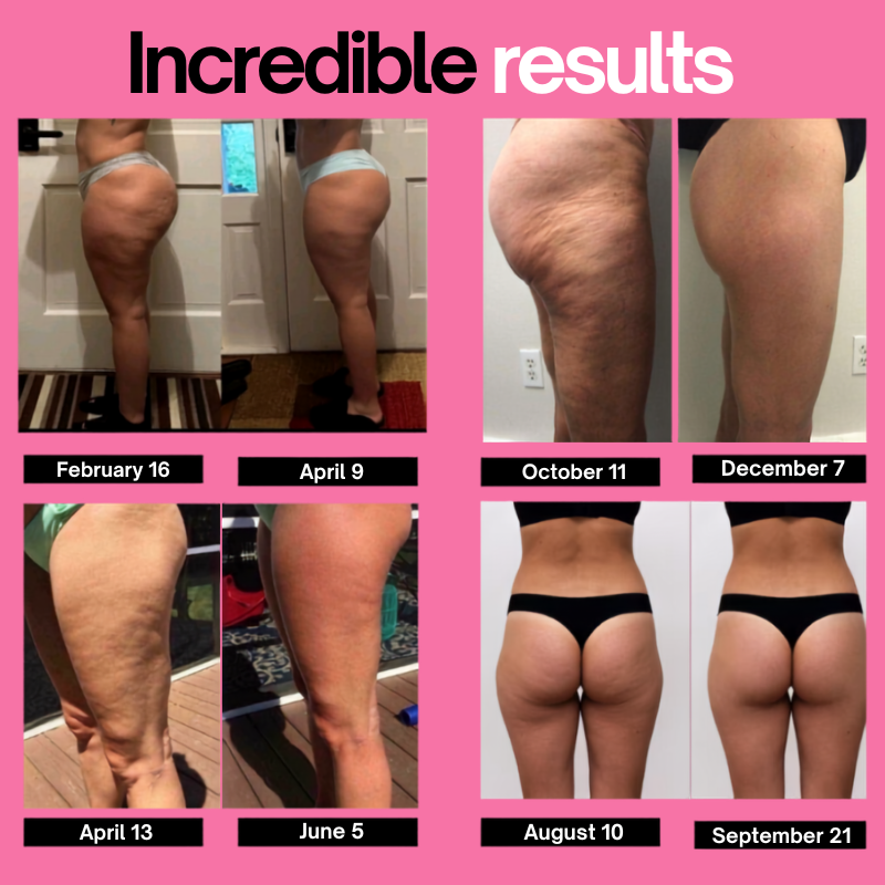 VELORA™ | Anti Cellulite Legging
